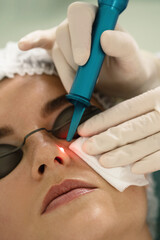 Woman during laser mole removal in a medical aesthetic clinic