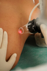 Dermatologist and woman client during laser skin resurfacing treatment in a medical aesthetic clinic