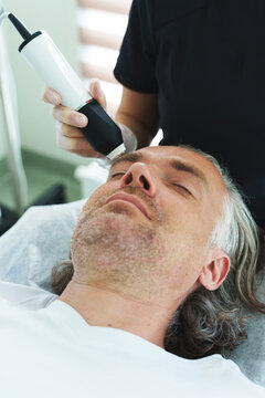 Middle Aged Man During Carbon Dioxide Laser Resurfacing In A Cosmetology Clinic