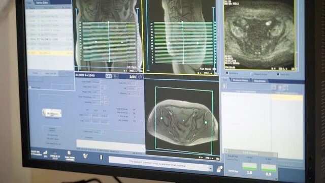 examination of the patient on the ultrasound monitor