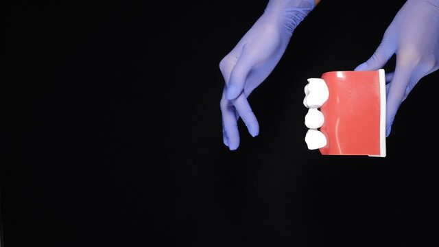 Dental concept on black background. Model of teeth and dental bridging being held by hands in blue gloves. Vertical footage. Removable partial denture, mandibular prosthesis. Medically prosthodontics