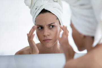 Head shot close up unhappy young hispanic latin woman touching eyes area, feeling dissatisfied with...