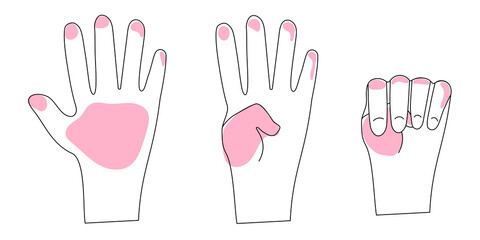 The Signal for Help, single-handed gesture. Violence at Home Signal for Help. Three hand images with pink stains. 