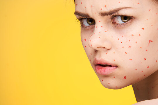 Woman With Red Dots On Her Face Skin Problems Dermatology Dissatisfaction