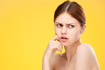 woman with bare shoulders red dots on her face health problems dermatology