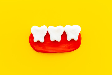 Teeth health and dental care. Teeth models with caries or plaque