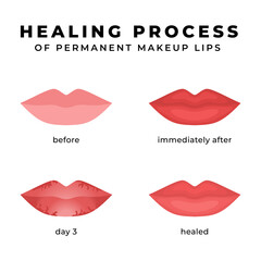 The healing process of permanent makeup lips - obrazy, fototapety, plakaty