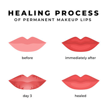 The healing process of permanent makeup lips