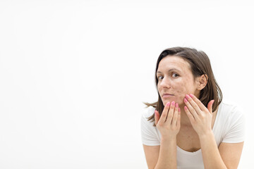 Photo of woman with dry skin touching her face on white background.