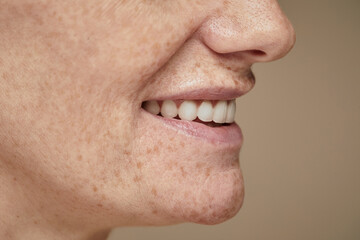 Side view close up of young woman with freckles smiling, focus on white teeth, copy space