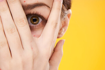 woman with red dots on her face skin problems dermatology dissatisfaction