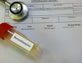 Urine sample and stethoscope isolated on positive Benzodiazepine patient report