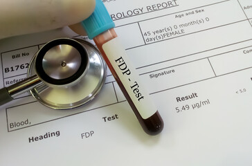 Technician hand blood tube and stethoscope isolated on FDP testing report. (Fibrin degradation...
