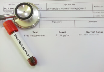 Blood tube and stethoscope isolated on abnormal Free Testosterone testing report.