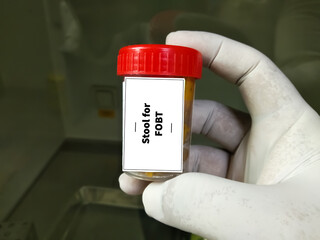 Fecal occult blood test (FOBT). Doctor holding sample container with feces or stool for occult...