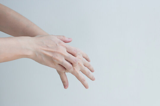 woman' hand are itching and scratching of skin diseases. Concept with a Healthcare And Medicine.