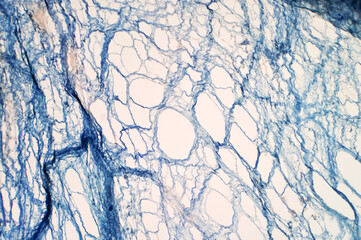 Areolar connective tissue under the light microscope view. Human pathology education.
