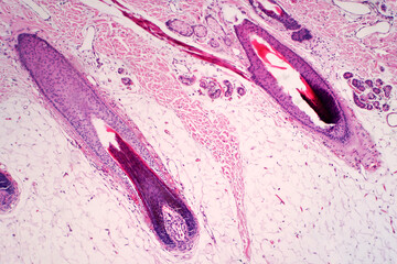 Histology of human scalp and hair follicle under the light microscope view.