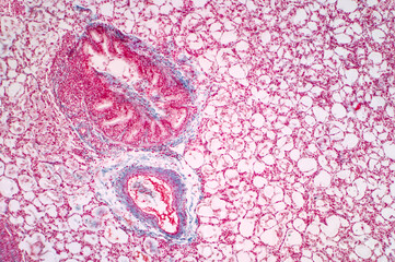 Human lung histilogy under light microscope, The lungs is organs of the respiratory system in...