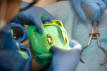 the dentist uses Cofferdam for the treatment of a child