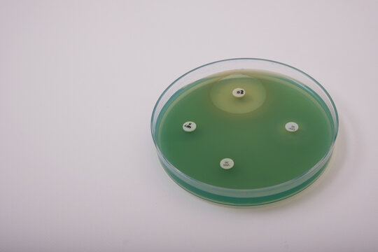 photo of growth of pseudomonas bacteria on nutrient agar with antibiotic discs to test the resistance