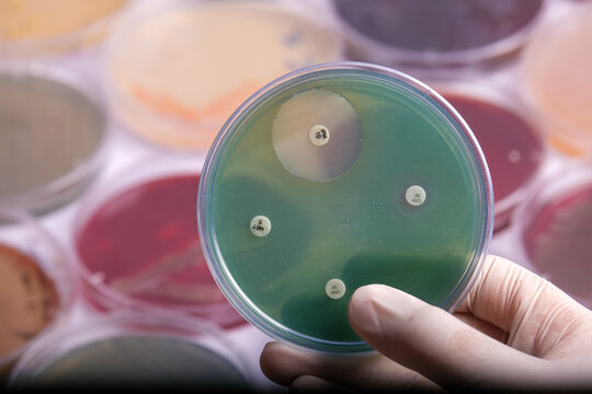 collection of culture plates contain growth of microorganisms on different agar media