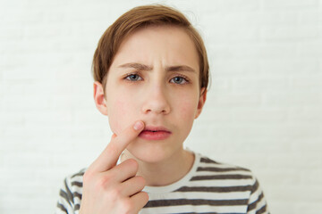 Fototapeta premium Teen boy looks at his first mustache in mirror, puberty period, early adulthood