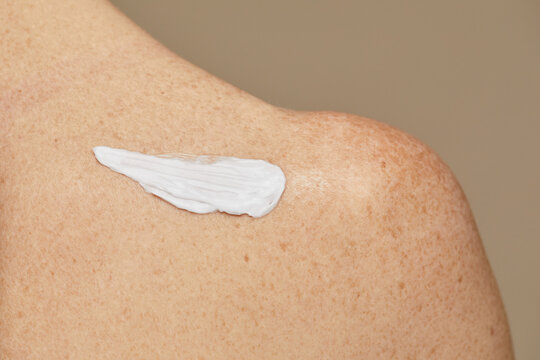 Close Up Of Body Cream On Elegant Nude Shoulder With Freckles, Copy Space