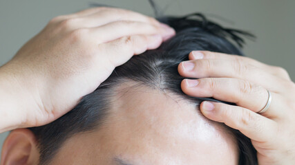 Fototapeta na wymiar 髪の生え際を確認する中年男性