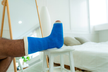 On the right side of the right foot, a man who had a fractured bone accident had a blue cast...