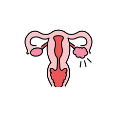 Polycystic ovary syndrome line color icon. Female reproductive system disease