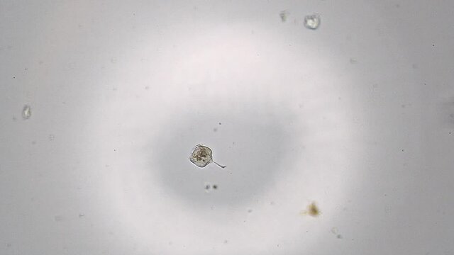 Vorticella. Bell-shaped ciliate float in circle under microscope with brightfield illumination