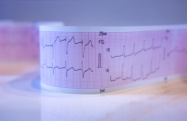 Close-up of a graph paper strip with black heart waves forming an electrocardiogram.