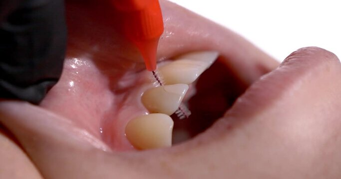 dentist cleans a toothbrush between the patient's teeth frame close-up macro