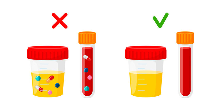 Laboratory test for doping. Concept for the maintenance of medicines in the blood and urine of athletes. Containers for analysis with and without doping flat vector illustration.