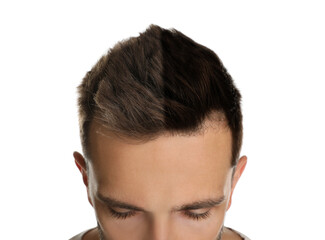 Closeup view of man before and after hair dyeing on white background