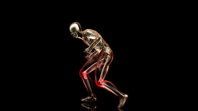 man having painful joints while running, anatomy, runner suffering with pain on sports running knee injury, Jogging injury, over trained person, medically accurate, 3d render