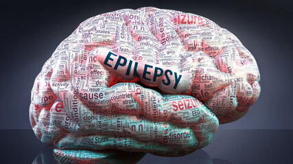 Epilepsy in human brain, hundreds of crucial terms related to Epilepsy projected onto a cortex to show broad extent of the condition and to explore concepts linked to it, 3d illustration - obrazy, fototapety, plakaty