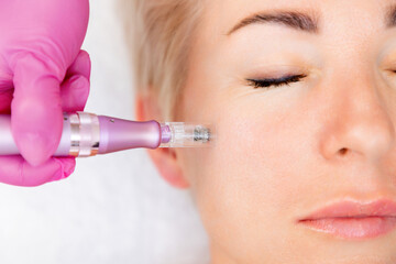 Anti-aging treatment and face lift. Close upportrait of adult woman at a mesotherapy procedure in...