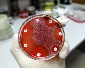 Culture media plate of bacterial growth showing antibiotic sensitivity in their colony. Antibiotic...