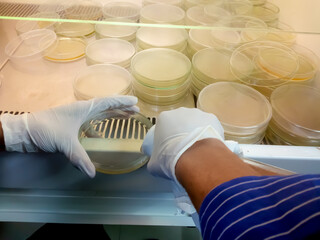 Medical Technologist pouring culture media into petri dish which is then use for microbial culture....