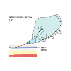 Intravenous injection. Effective methods of administration of drugs and other medical solutions that are used for humans and animals. Vector illustration isolated on white background.