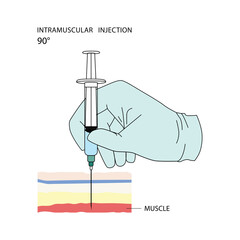 Intramuscular injection. Effective methods of administration of drugs and other medical solutions that are used for humans and animals. Vector illustration isolated on white background.