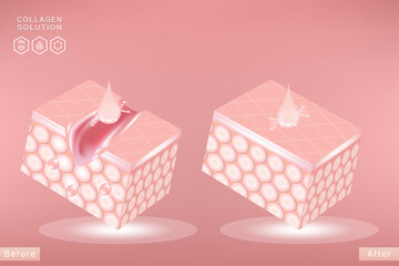 Hyaluronic acid before and after skin solutions ad, pink collagen serum drops with cosmetic advertising background ready to use, illustration vector.