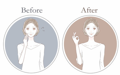 悩んでいる中年女性のビフォーアフター