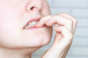 Young nervous caucasian woman bitting nails close up. Anxious, stressed, frustrated, embarrassed,...