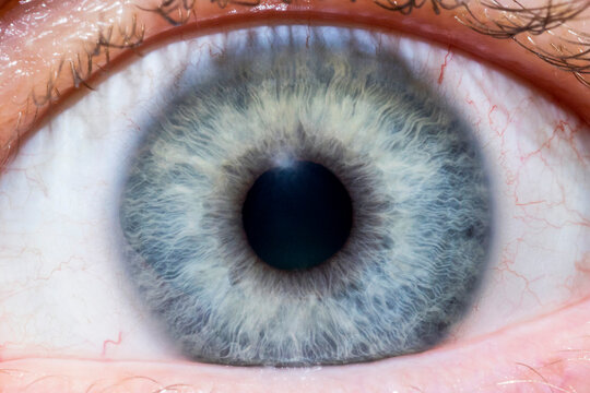 Iris