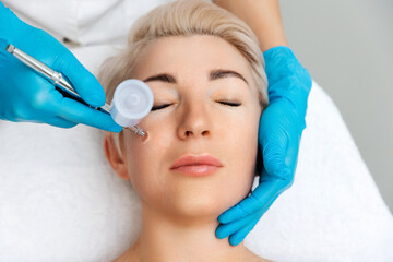 Cosmetologist in blue gloves does a gas-liquid peeling procedure of the client's face. Top view....