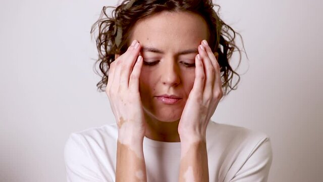 Girl with autoimmune disease vitiligo covers her face with her hands. Close-up portrait