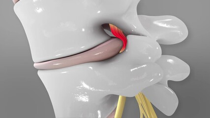 Herniated Disc Flexion 3D Animation 
